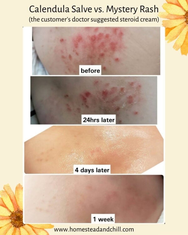 Organic Calendula Salve (Soothe Any Skin Issue!) - Image 4